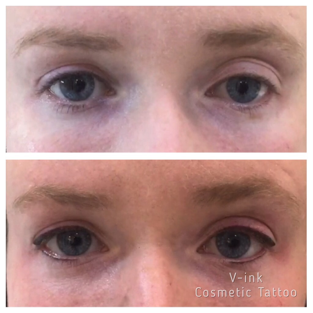 before and after Eyeliner Tattoo Melbourne